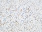 XIAP Polyclonal Antibody